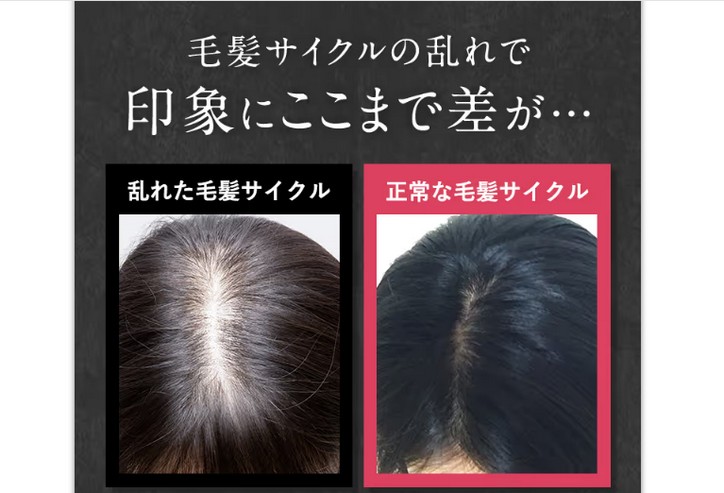 若々しいしなやか美髪に導く【FUSARI薬用育毛剤】について